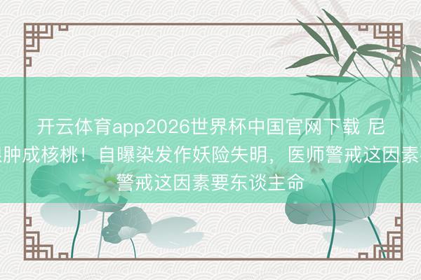 开云体育app2026世界杯中国官网下载 尼格买提右眼肿成核桃！自曝染发作妖险失明，医师警戒这因素要东谈主命